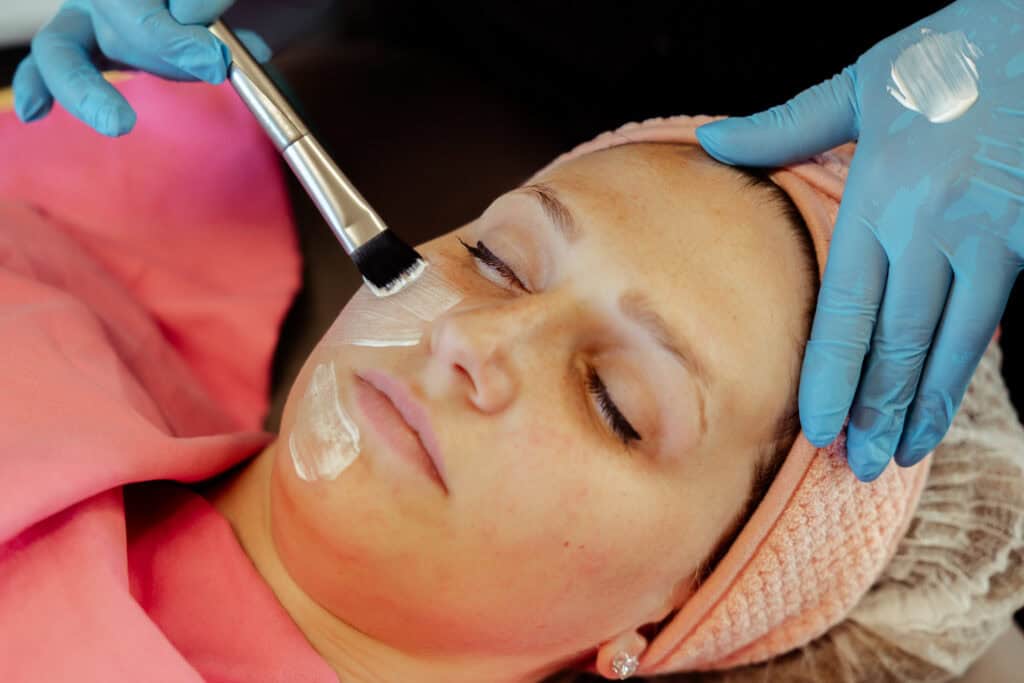 Meso Micr Needling Blog 03